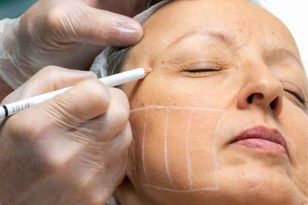 CryoPen: 5 Skin Concerns It May Be Used to Treat 4 What should you ask before having CryoPen treatment Groby?